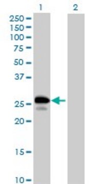 Anti-UBE2J2 antibody produced in mouse