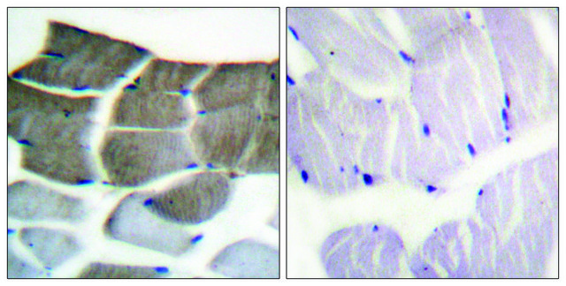 Anti-ACC1 antibody produced in rabbit