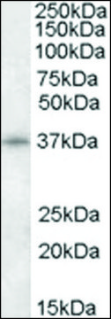Anti-CDK10 (N-terminal) antibody produced in