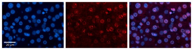 Anti-RUNX1T1 antibody produced in rabbit