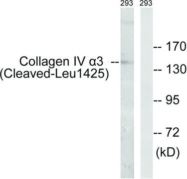 Anti-Collagen IV ?3 (Cleaved-Leu¹?²?) antibody
