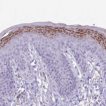 Anti-CLEC2A antibody produced in rabbit