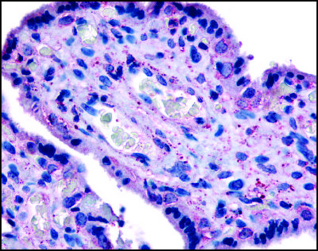 Anti-SLC7A5 (AB2) antibody produced in