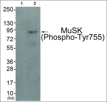 Anti-phospho-MuSK (pTyr???) antibody produced in