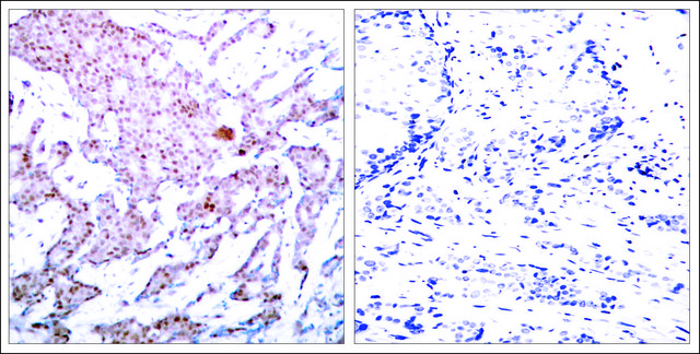 Anti-phospho-RELA (p65/pSer?³?) antibody produced in