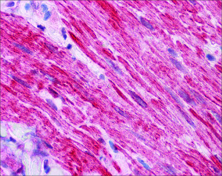Anti-DVL2 antibody produced in rabbit