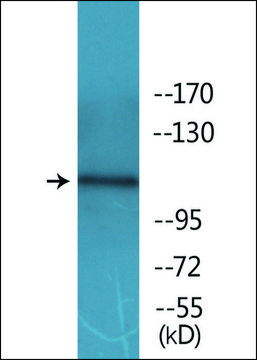Anti-phospho-EPHB1/2 (pTyr594/604) antibody produced in