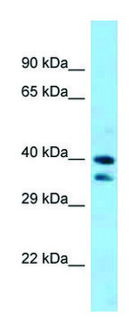 Anti-Sav1 (C-terminal) antibody produced in
