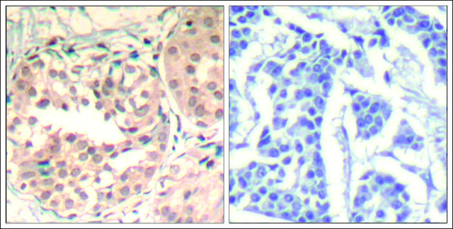 Anti-phospho-CDK6 (pTyr¹³) antibody produced in