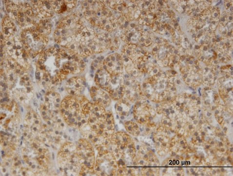 Monoclonal Anti-CDR2 antibody produced in