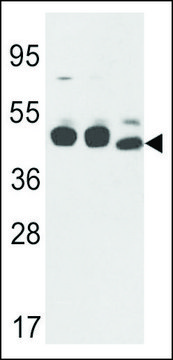 ANTI-CYK18(C-TERMINAL) antibody produced in rabbit