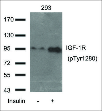 Anti-phospho-IGF-1R (pTyr¹²??) antibody produced in