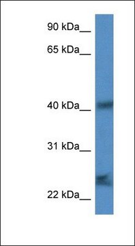Anti-SCAMP1 antibody produced in rabbit