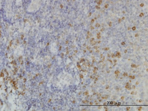 Monoclonal Anti-SSR1, (C-terminal) antibody produced