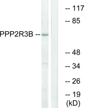 Anti-PPP2R3B antibody produced in rabbit