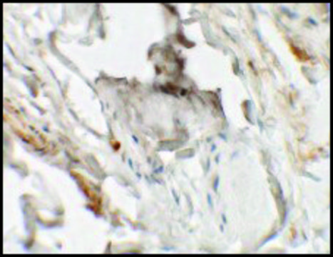Anti-HHATL antibody produced in rabbit