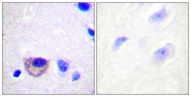 Anti-ATPASE antibody produced in rabbit