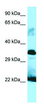 Anti-GH1 (C-terminal) antibody produced in