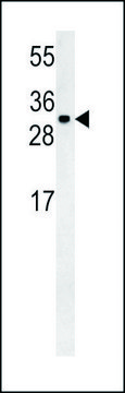 ANTI-TM2D3 (N-TERM) antibody produced in