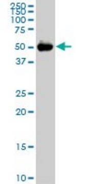 Monoclonal Anti-CDADC1, (C-terminal) antibody produced