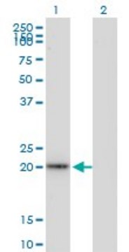 Monoclonal Anti-TAGLN antibody produced in
