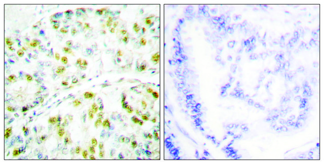 Anti-Ataxin 1, C-Terminal antibody produced