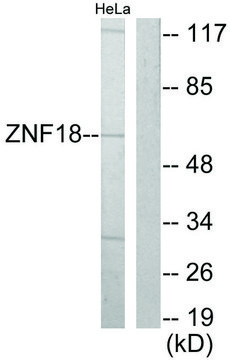 Anti-ZNF18 antibody produced in rabbit