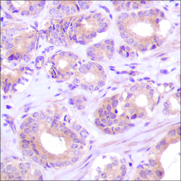 Anti-PTEN antibody, Rabbit monoclonal