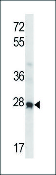 ANTI-MOUSE HOXA4 (N-TERM) antibody produced