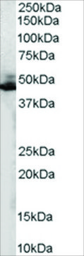 Anti-ADRB2R/ADRB2 antibody produced in goat