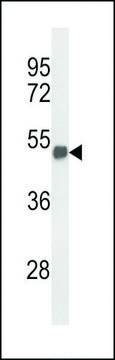 ANTI-FOXG1 (CENTER) antibody produced in
