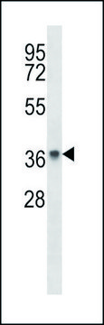 ANTI-PAQR8 (C-TERM) antibody produced in