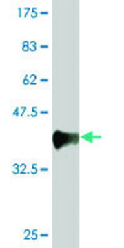 Monoclonal Anti-DLG1, (N-terminal) antibody produced
