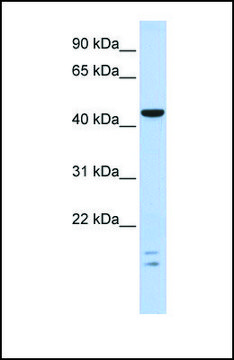 Anti-BTBD6 antibody produced in rabbit