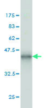 ANTI-ERN1 antibody produced in mouse