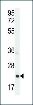 ANTI-ASCL2 (N-TERM) antibody produced in