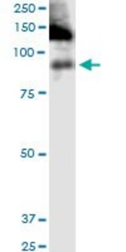 Monoclonal Anti-ITGB2 antibody produced in