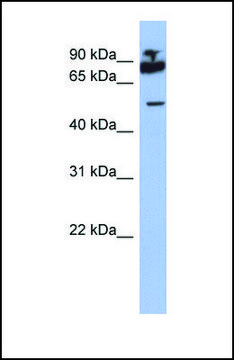 Anti-IKZF1 antibody produced in rabbit