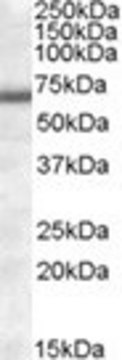 Anti-COL4A3BP (AA 396-411) antibody produced