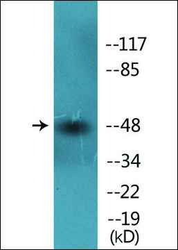 Anti-phospho-Smad3 (pSer?²?) antibody produced in
