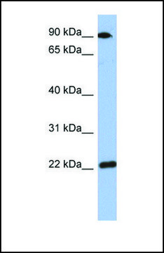 Anti-TMED10 antibody produced in rabbit