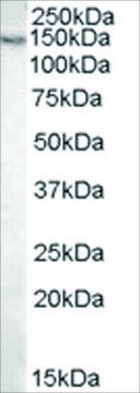 Anti-Pyruvate Carboxylase antibody produced in