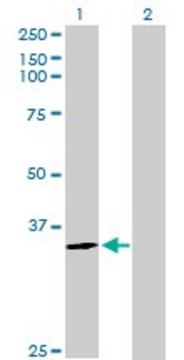 Anti-HNMT antibody produced in rabbit