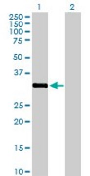 Anti-STK16 antibody produced in rabbit