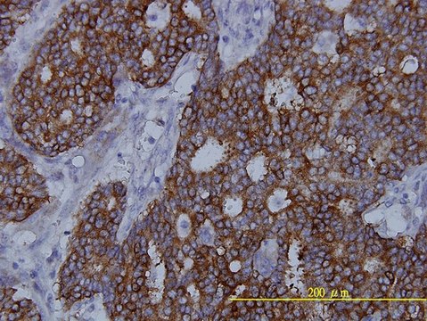 Monoclonal Anti-FASN antibody produced in