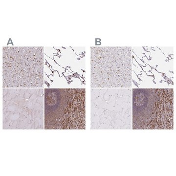 Anti-PYCARD antibody produced in rabbit