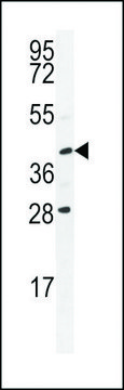 ANTI-USP50 (CENTER) antibody produced in