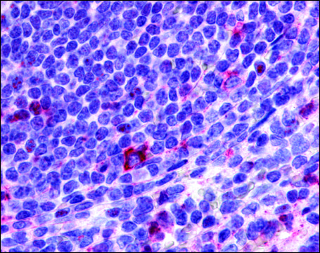 Anti-CCR2 antibody produced in rabbit