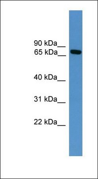 Anti-MASP2 antibody produced in rabbit