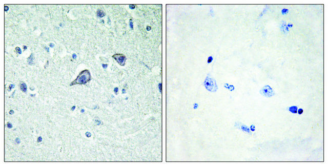 Anti-ADORA2A antibody produced in rabbit